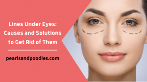 Lines Under Eyes Causes and Solutions to Get Rid of Them