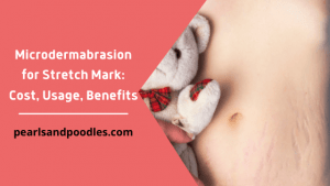 Microdermabrasion for Stretch Mark Cost, Usage, Benefits